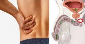 cancer_de_prostata